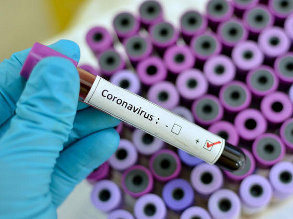 На Донетчине продолжает расти количество заболевших коронавирусом COVID-19