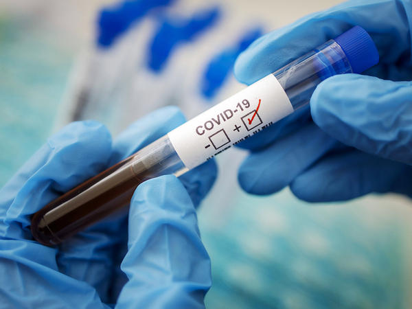 На Донетчине появится еще одна лаборатория для диагностики коронавируса COVID-19