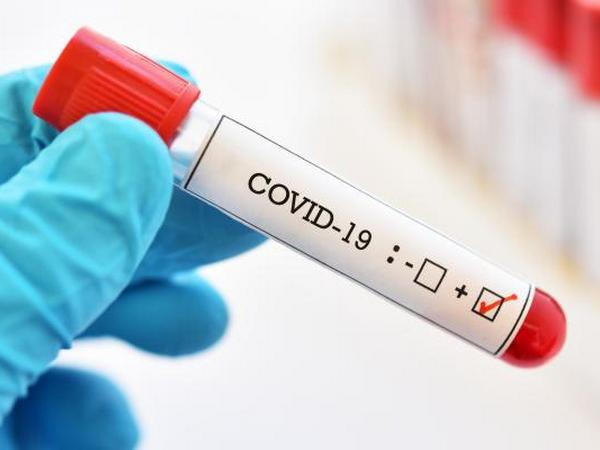 На Донетчине подтвержден сотый случай заболевания COVID-19