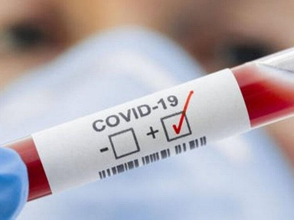 На Донетчине выявлено 5 новых случаев COVID-19
