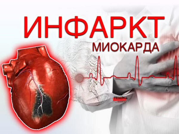 Ситуация с больными инфарктом миокарда в Марьинском и Великоновоселковском районе не радует