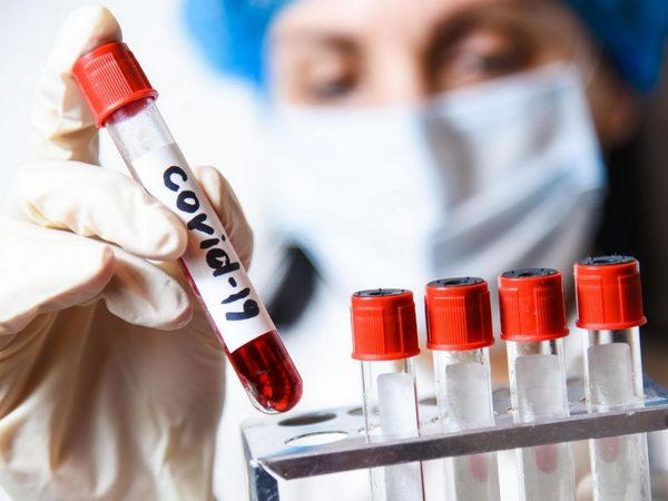 В Великоновоселковском районе зафиксировано 532 случая COVID-19, из которых 18 - оказались смертельными