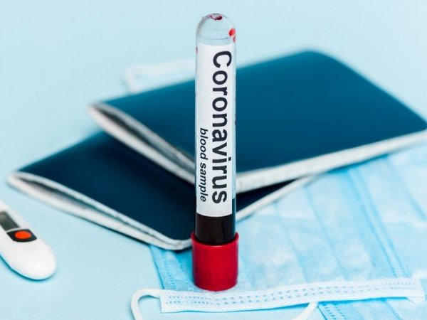 На Донетчине выявлен 141 новый случай COVID-19, в том числе в Марьинской и Великоновоселковской ОТГ