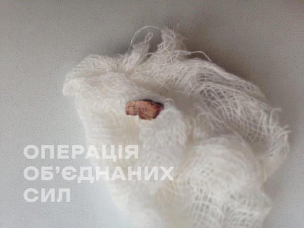 В результате вражеского минометного обстрела ранен житель Красногоровки