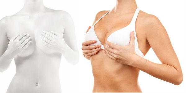 Маммопластика – операция по увеличению груди