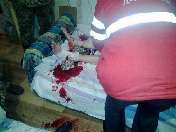 Мужчина, раненный в результате обстрела Красногоровки, оказался тестем российского военного