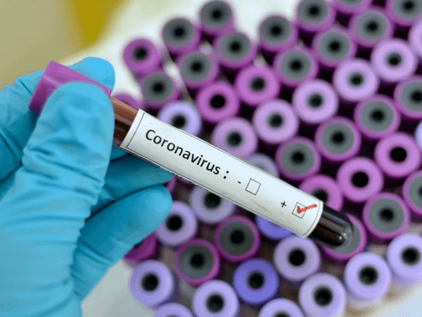 В Украине зафиксирован первый случай заболевания коронавирусом
