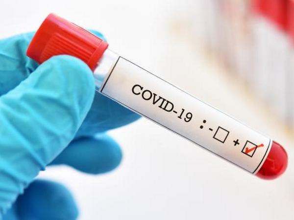 На Донетчине официально подтвержден десятый случай заболевания коронавирусом COVID-19