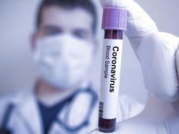 На Донетчине зафиксирован первый случай выздоровления от коронавируса COVID-19