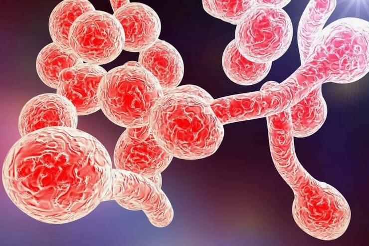 что такое кандидоз