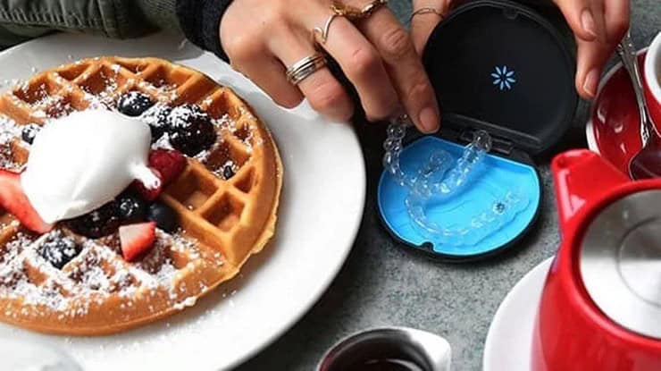 Елайнери: сучасне рішення для рівної посмішки